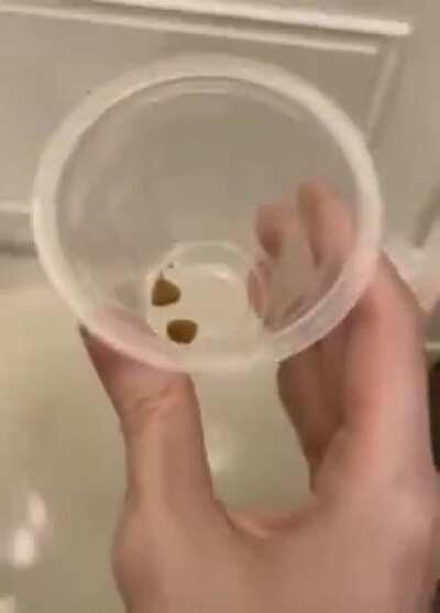 Putting the dog on a diet.