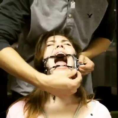 Open mouth gag