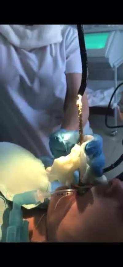 Bring me the flame thrower!