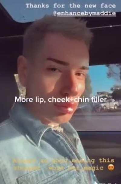 Tell me he wasn't good looking before 🤧 why change it.