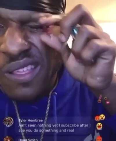man lights fire cracker in his eye