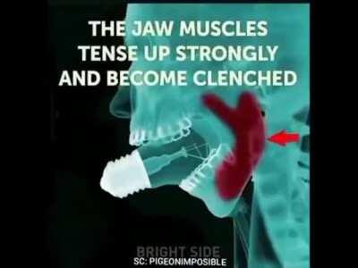 Información que no necesitaban saber: Puedes meter un foco a tu boca, pero no puedes sacarlo. No lo intenten! (Guiño, guiño)