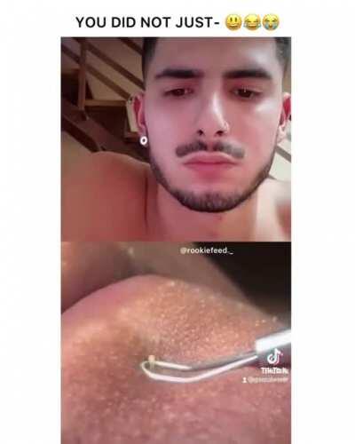 Thanks, I hate noodles.