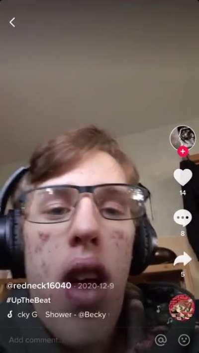 When your face is a Little Caesar’s pizza