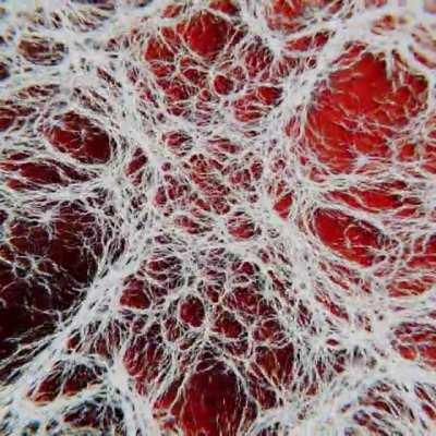 Nervous system on LSD, By me, Does this make you trip?