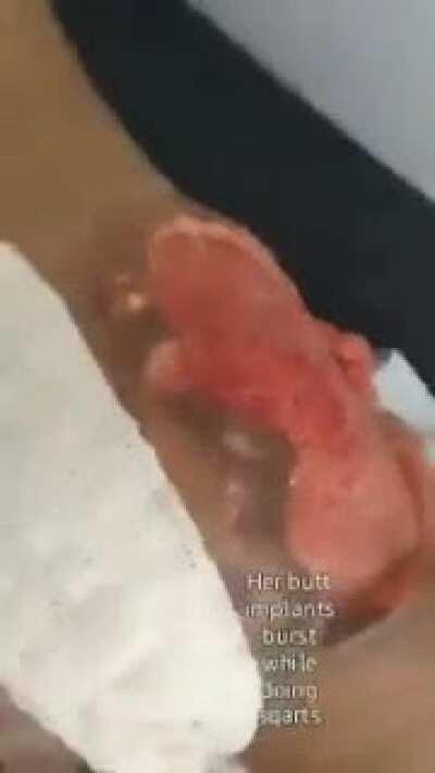 Hell of a fleshwound