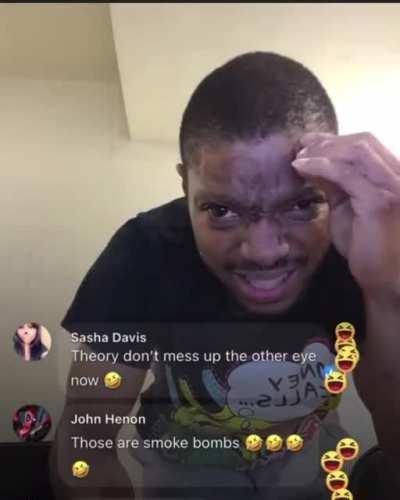 Idiot playing with fire crackers