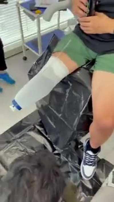 Prosthetic leg installation