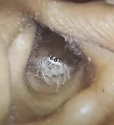 Spider in an ear 🕷️🕸️