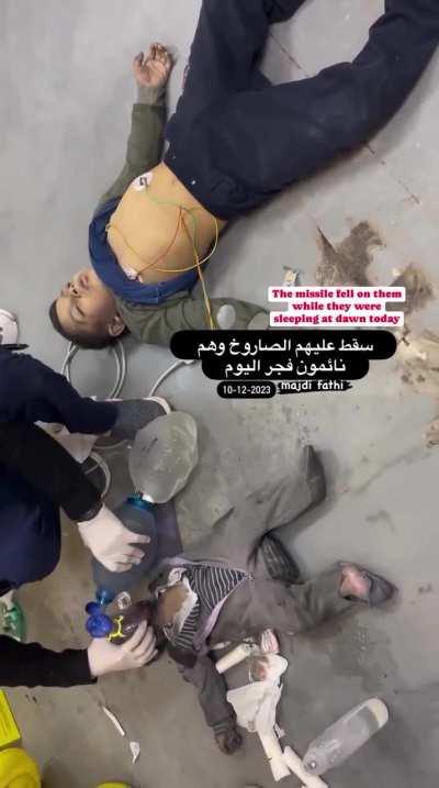 Children suffer from burns and injuries by an Israeli air strike that bombed their home whilst they were sleeping, pre dawn today. 10.12.23