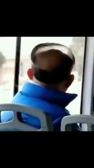 to not accept your hair loss