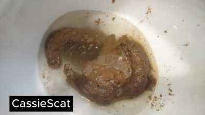 Second Time with Laxatives: Toilet, Sink, Trash Can [GIF]