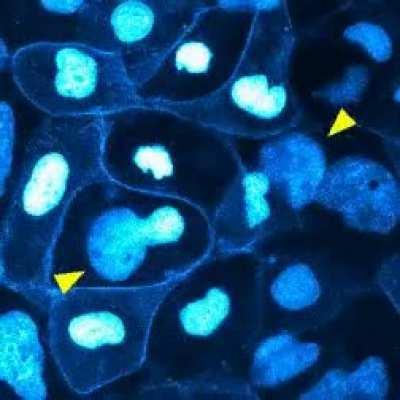 Cell division at high resolution in case anyone is curious. You can even see the individual chromatin condenses into chromosomes before being pulled apart. The nucleus is visible because I tagged the cells with a protein called Histone-mCherry that binds 