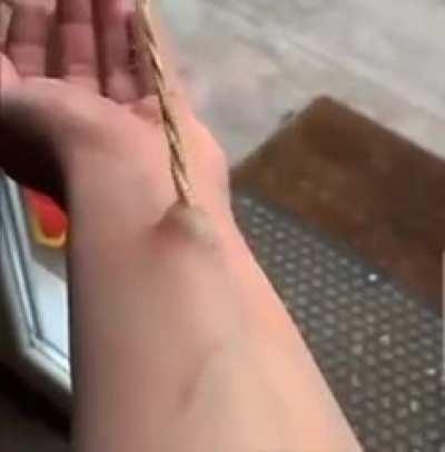 RIP THEIR CORDS FROM UNDER YOUR SKIN