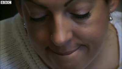 Foreign accent syndrome