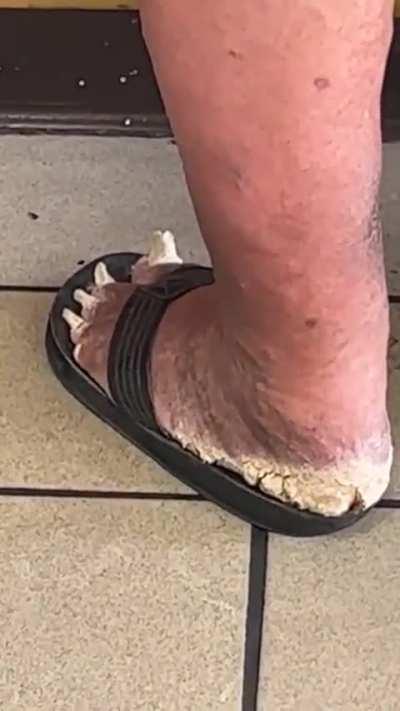 🤔 it looks itchy enough, btw can someone tell me what is this ? 