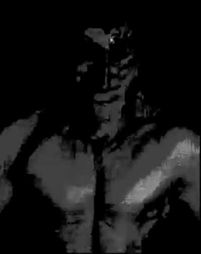 When the schizophrenia episode kicks in