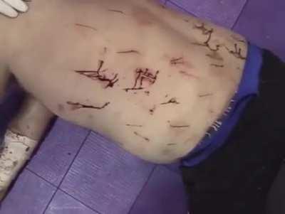 Watch this dude land on a razor board