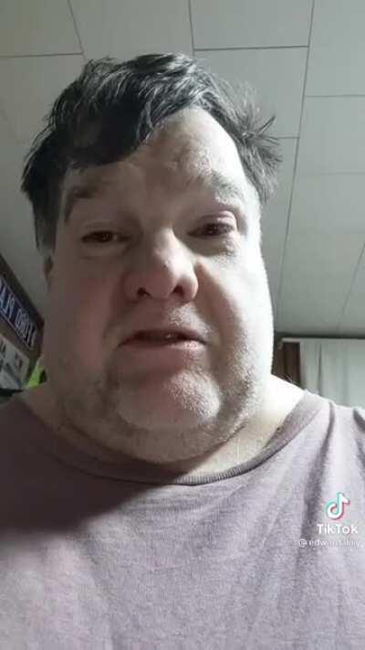 I do know the similarity is that he has neither of them