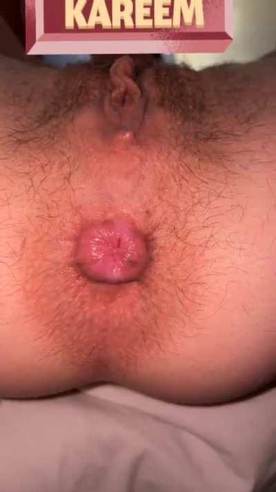 You favorite farting ass😋😮‍💨Dm me