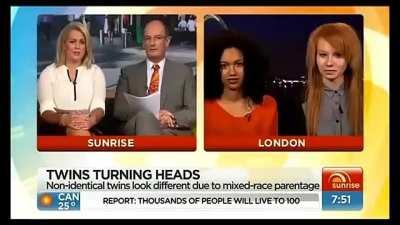 I don’t know who died worse here.