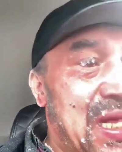 A man's car broke down on the highway. He went outside for a while and froze his ears off.