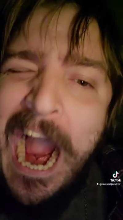 How can you bite your saliva glands when they can't even reach the top of your teeth!?