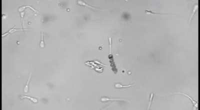 A nanobot picks up a sperm by the tail and inseminates an egg with it, by the Institute for Integrative Nanosciences in Germany