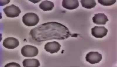 Bacteria vs globulo branco ao som de link park 😎👍 ( luta mto foda)