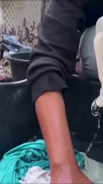 An emotional journey captured in a single sentence. This Gazan girl's relentless search for water reflects the daily struggles faced in a war-torn enclave