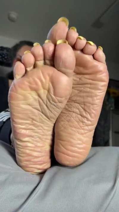WRINKLES