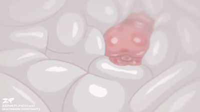 White room: zonkpunch