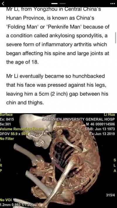 A man folded in half. “Unfold. A new way to snap”