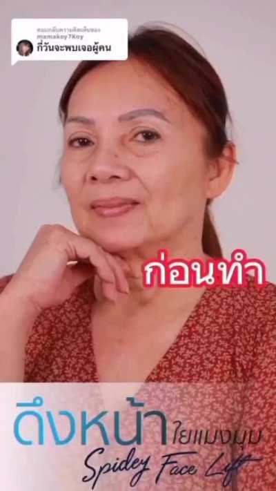 Thai Facelift