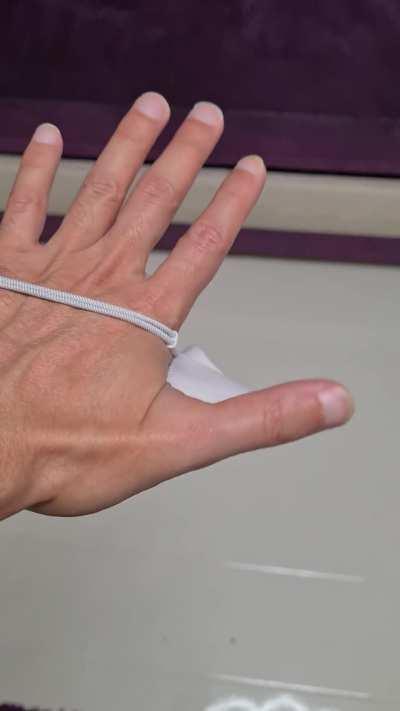 Knuckle strap w/o knuckle strap hack