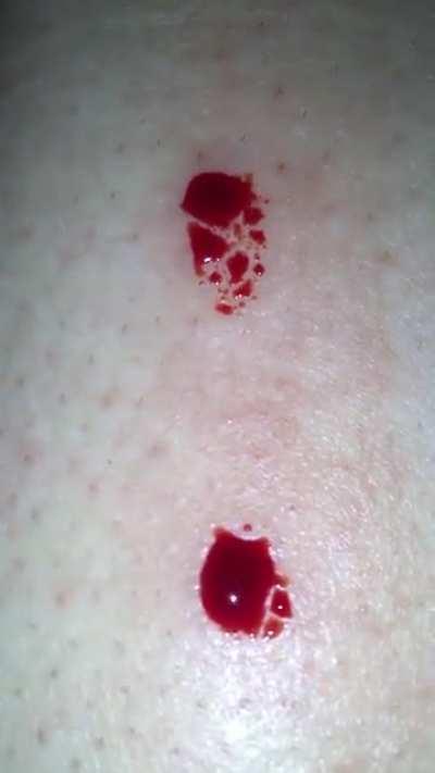 Sliced my skin shaving