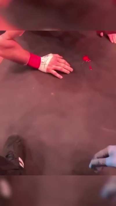 His Nose Was Leaking 🩸 