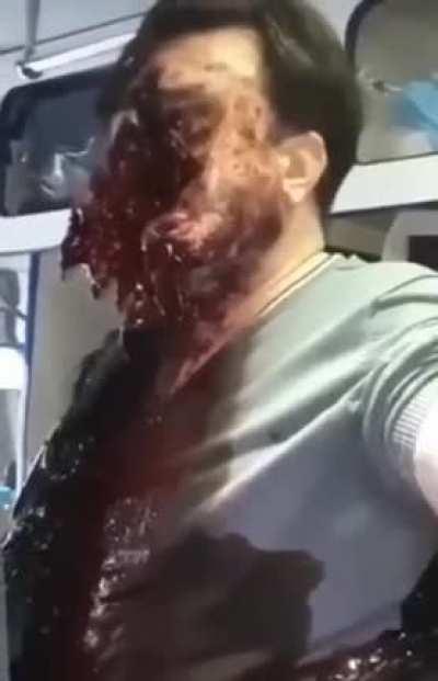 man fails suicide attempt