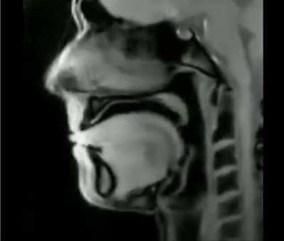 MRI of a person speaking (found it really interesting)