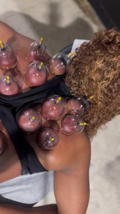 Sorry for the late post but Today I did some therapy on my upper body muscles mostly in my back. As you all know I have been training my upper body more than I’m use to so everything was so tight and needed some adjusting and releasing.