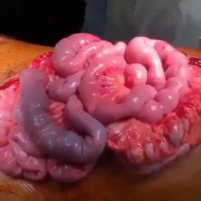 Intestinal peristalsis