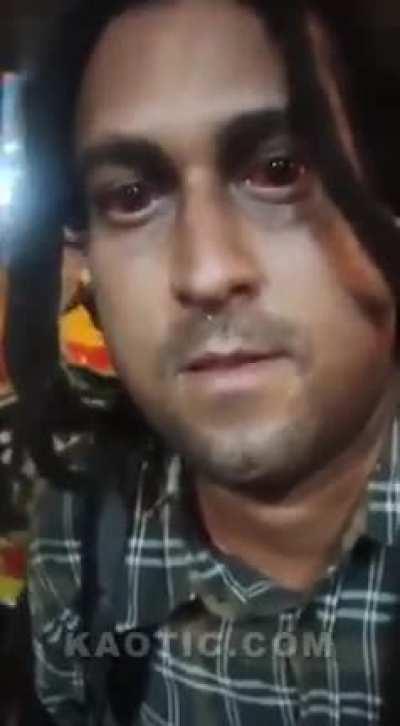 Those eyes are like saucers!