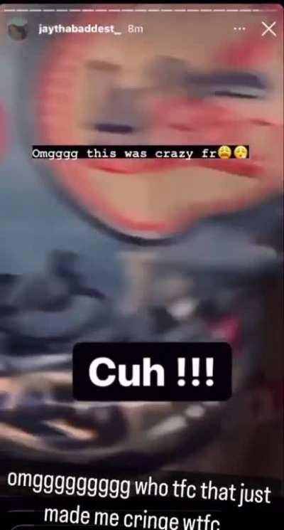 Fireworks blew his hand off