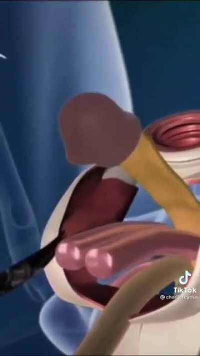 Yo y los panas yendo a crear un only fans