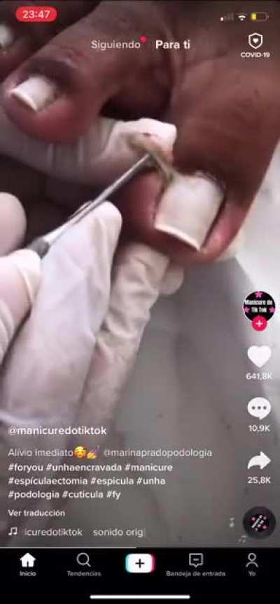 Can’t imagine the instant relief