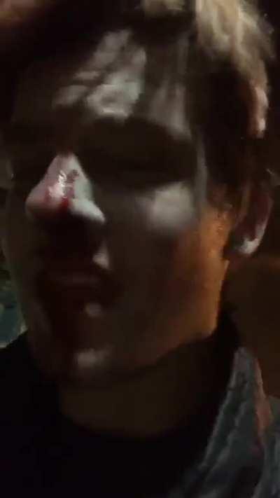 my friend’s instagram live from Denver last night after the police shot him in the face with pepper pellets