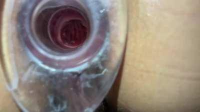 I got a plug that lets you see inside my hole daddy