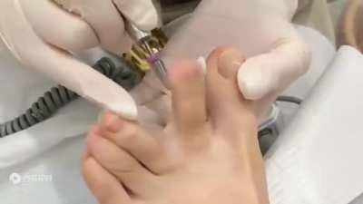 Thanks, I hate how this pedicures work