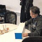 12 year old boy putting on a bionic arm for the first time