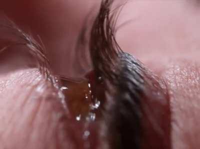 Eye drops in slowmo